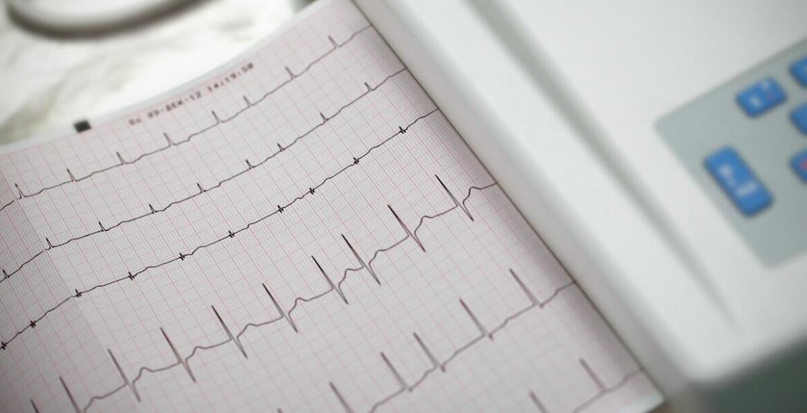 Jakie są wskazania do wykonania echo serca u psa?