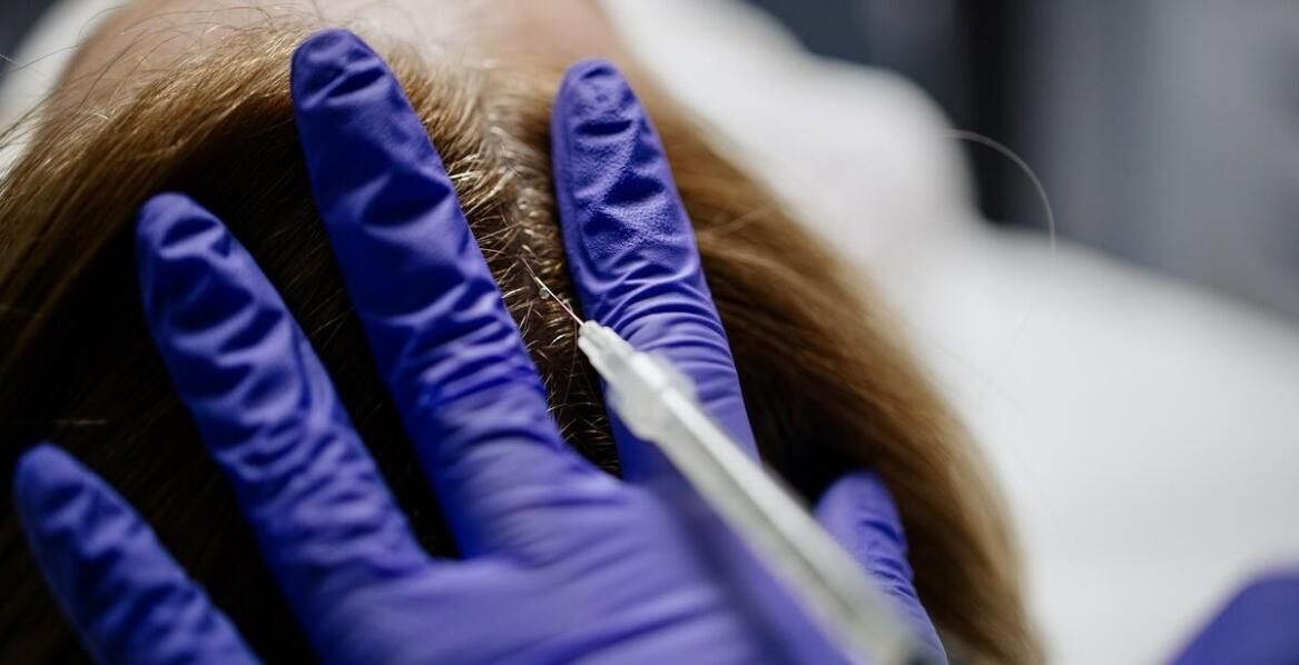 Terapie regeneracyjne w medycynie estetycznej