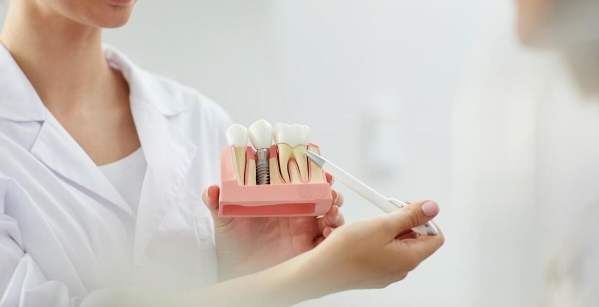 Wpływ implantów zębowych na jakość życia pacjentów