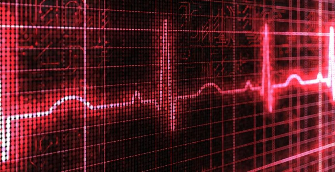 Jak przebiega badanie EKG serca i dlaczego jest ważne?