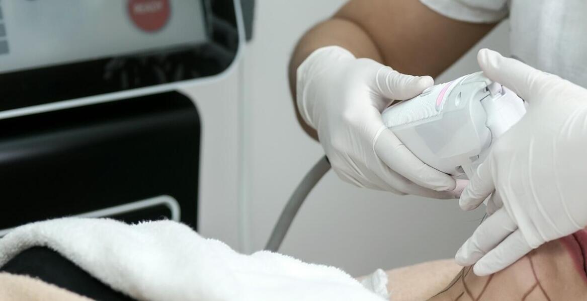 Usunięcie podbródka a nowoczesne podejście do medycyny estetycznej