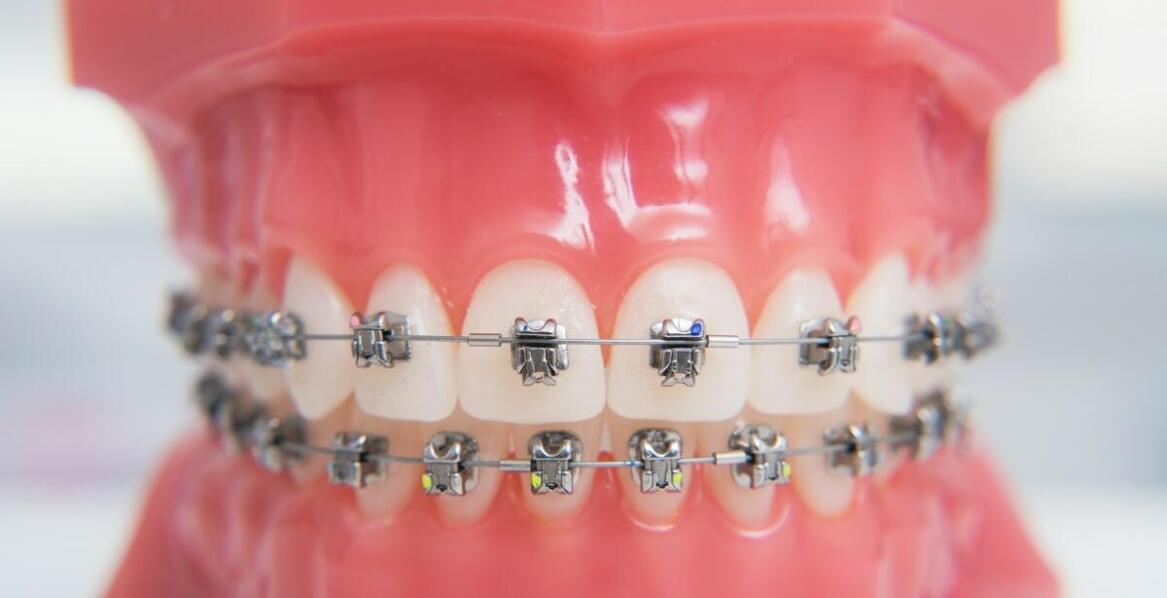 Czy leczenie wad zgryzu może poprawić jakość życia?