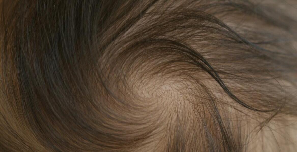 Jakie są objawy, które wskazują na potrzebę konsultacji z trychologiem?