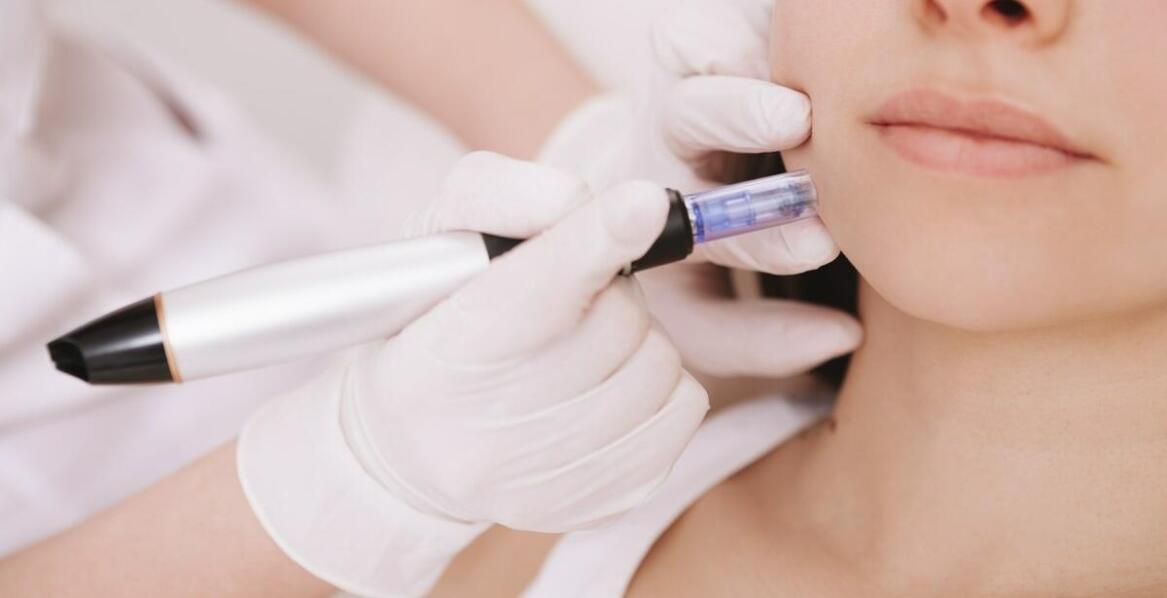 Mezoterapia dekoltu: najczęstsze pytania i odpowiedzi dotyczące zabiegu