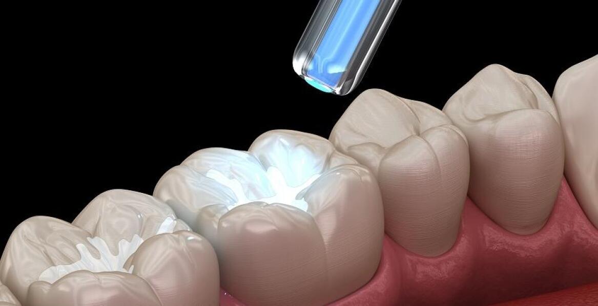 Odbudowa zębów po zabiegach chirurgii stomatologicznej: Co warto wiedzieć?