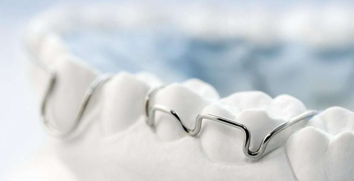 Aparaty stałe vs. niewidoczne – co wybrać przy leczeniu ortodontycznym?