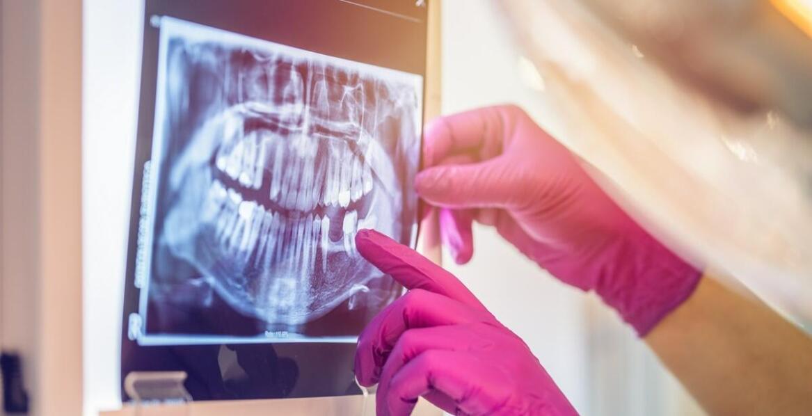 Jakie są kluczowe zastosowania pantomogramu w stomatologii?