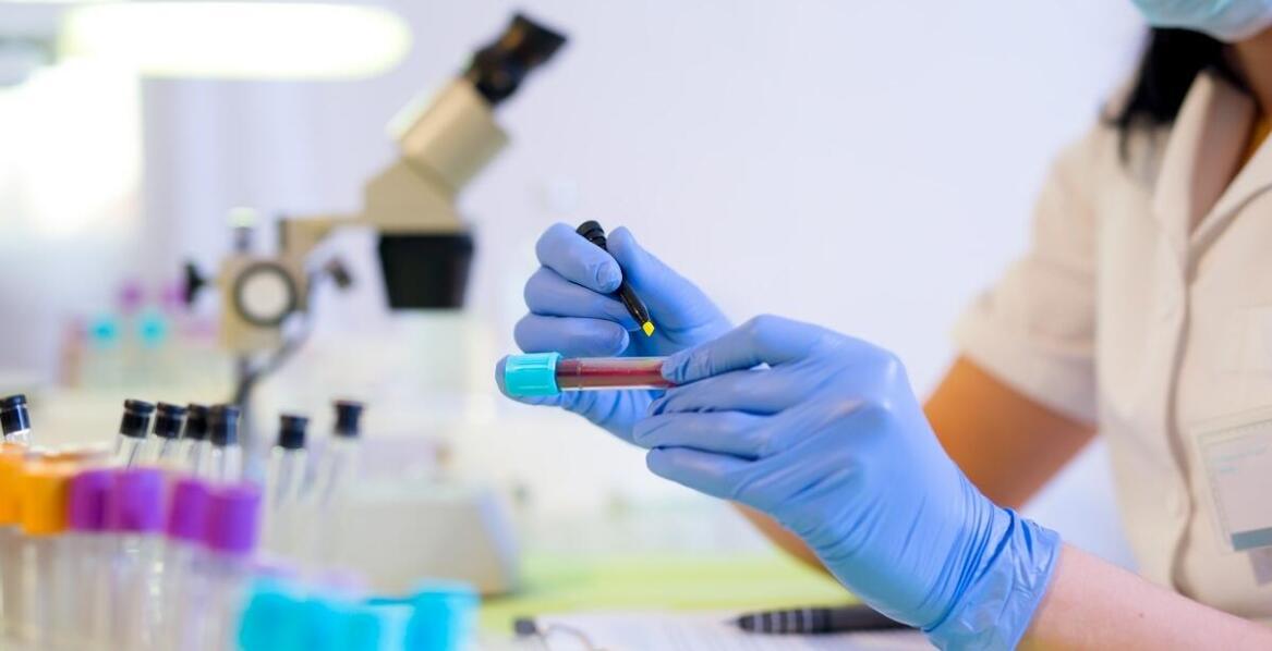 Znaczenie PCR w precyzyjnej identyfikacji materiału genetycznego patogenów