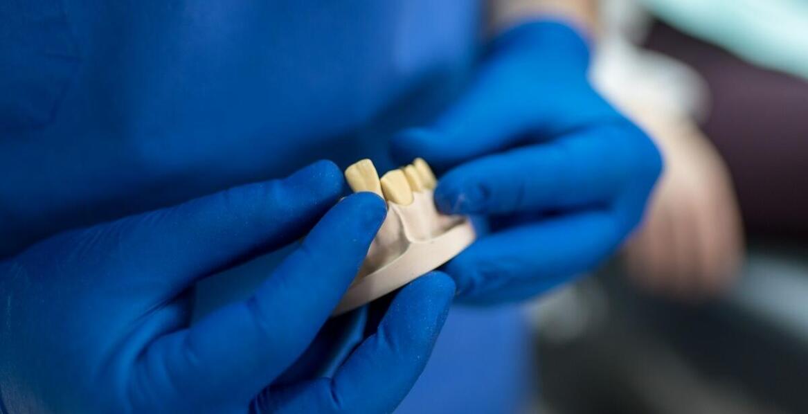 Dlaczego jakość materiałów jest kluczowa przy produkcji koron porcelanowych?