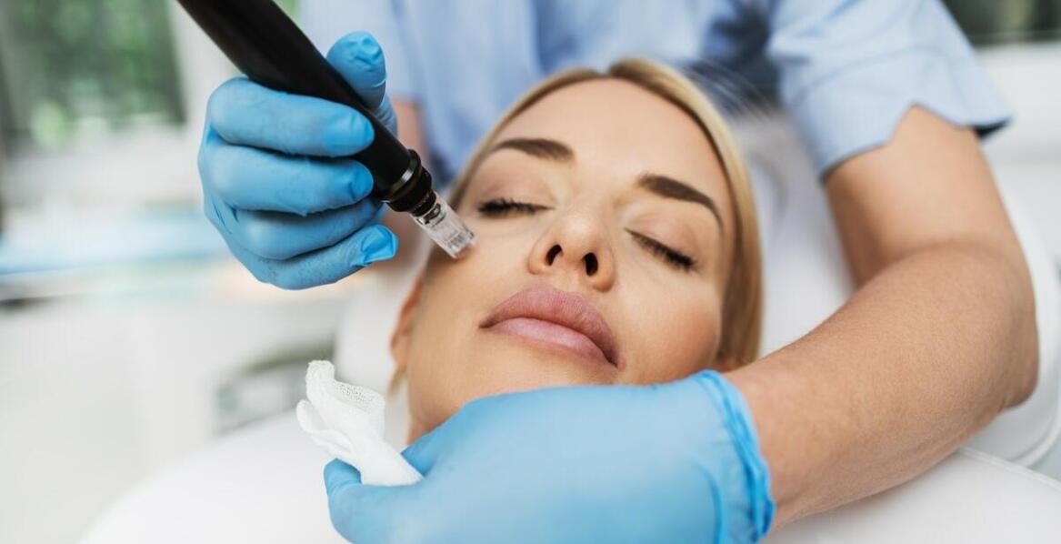 Mezoterapia mikroigłowa – innowacyjne podejście do pielęgnacji skóry