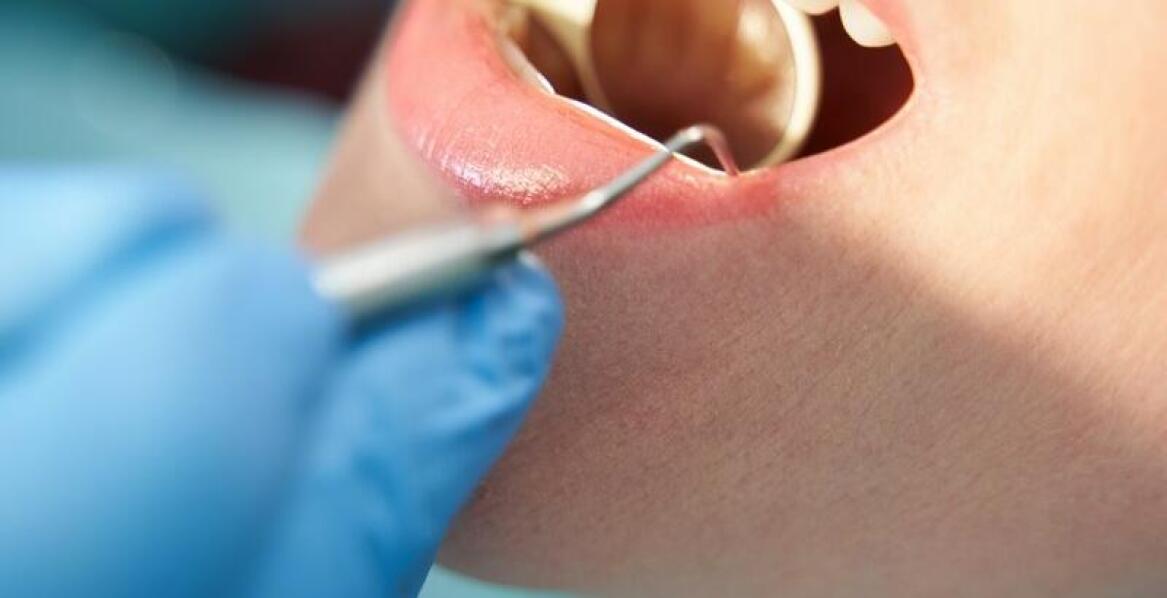 Reimplantacja złamanych zębów: jak szybko uzyskać pomoc stomatologiczną?