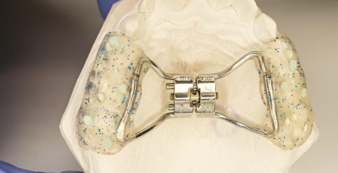 Jakie są etapy leczenia ortodontycznego dla dzieci i młodzieży?