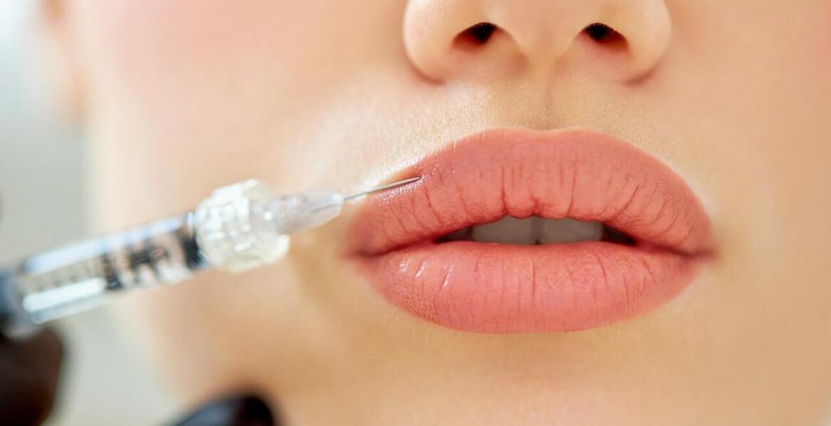 Wypełnianie kwasem hialuronowym: korzyści i efekty zabiegu