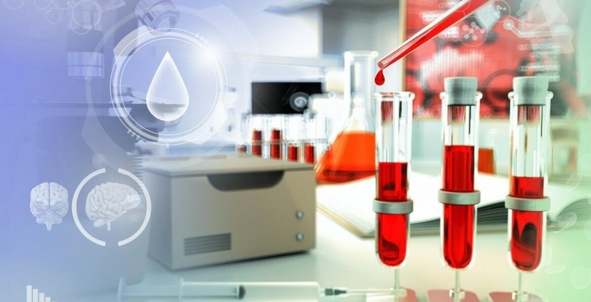 Wpływ nawodnienia na wyniki badań krwi: co musisz wiedzieć