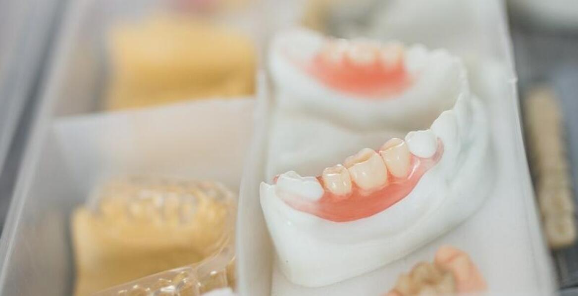 Wybór materiałów do implantów dentystycznych – co warto wiedzieć?