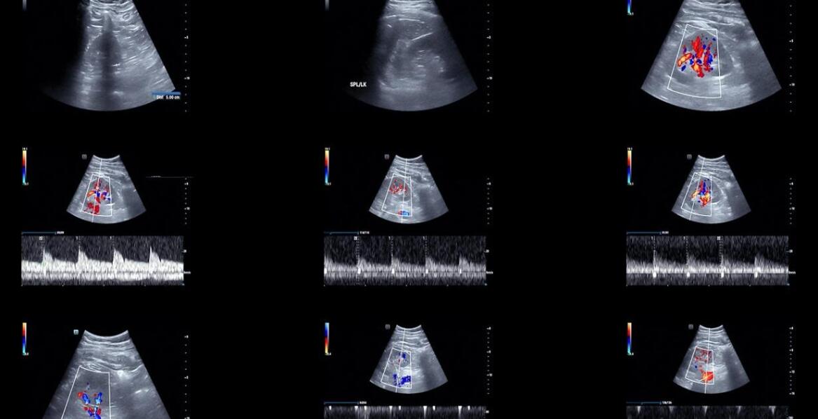 Spektrofotometry UV-Vis-NIR – zastosowania i zasada działania w analizie