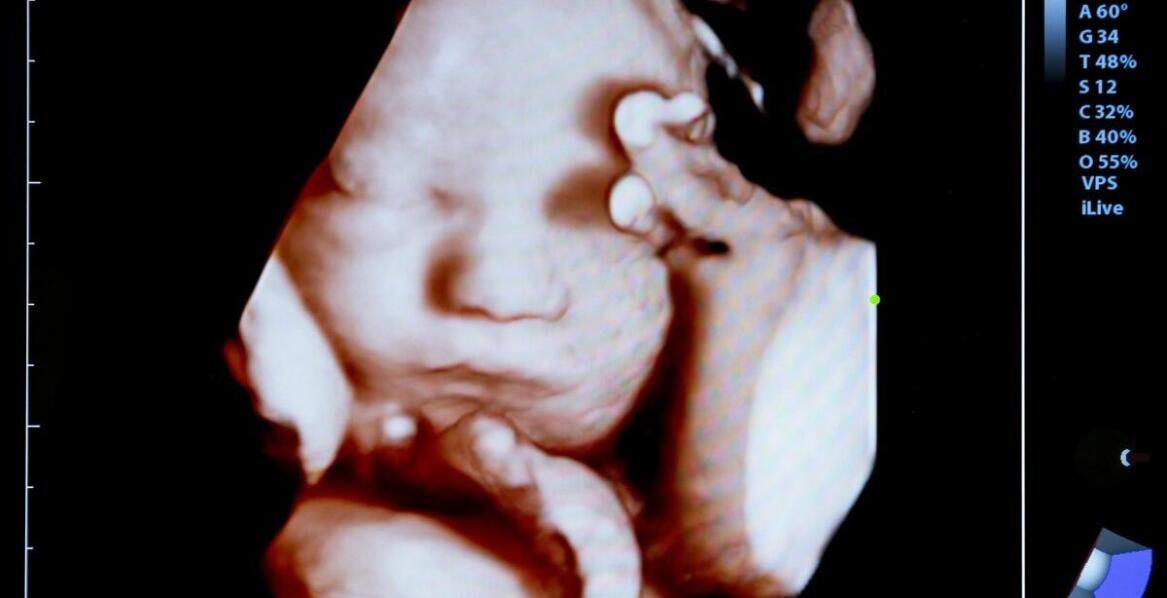 USG główki noworodka – przebieg badania i najważniejsze korzyści diagnostyczne