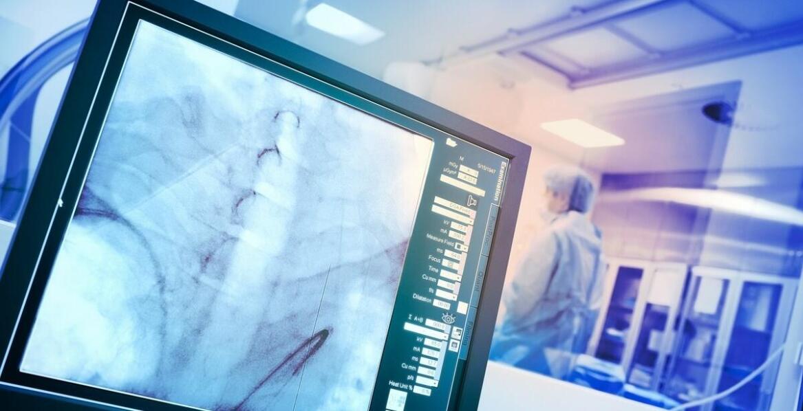 Rekonstrukcja ACL – cena a jakość usług medycznych