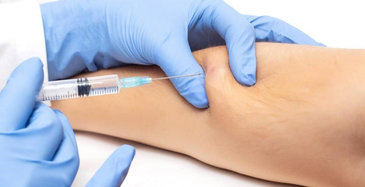 Terapia kolagenowa a mało inwazyjne leczenie stawów