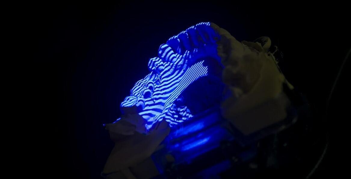 Jakie są najnowsze rozwiązania technologiczne w produkcji nakładek Invisalign?