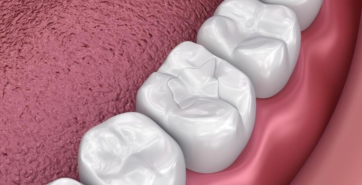 Jakie są najczęstsze zabiegi w ramach stomatologii zachowawczej?