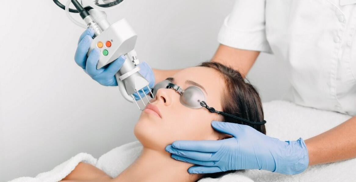 Peeling węglowo-laserowy jako sposób na odnowę skóry