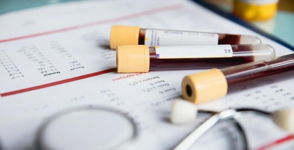 Dlaczego opaski identyfikacyjne dla pacjentów są niezbędnym elementem w szpitalach?