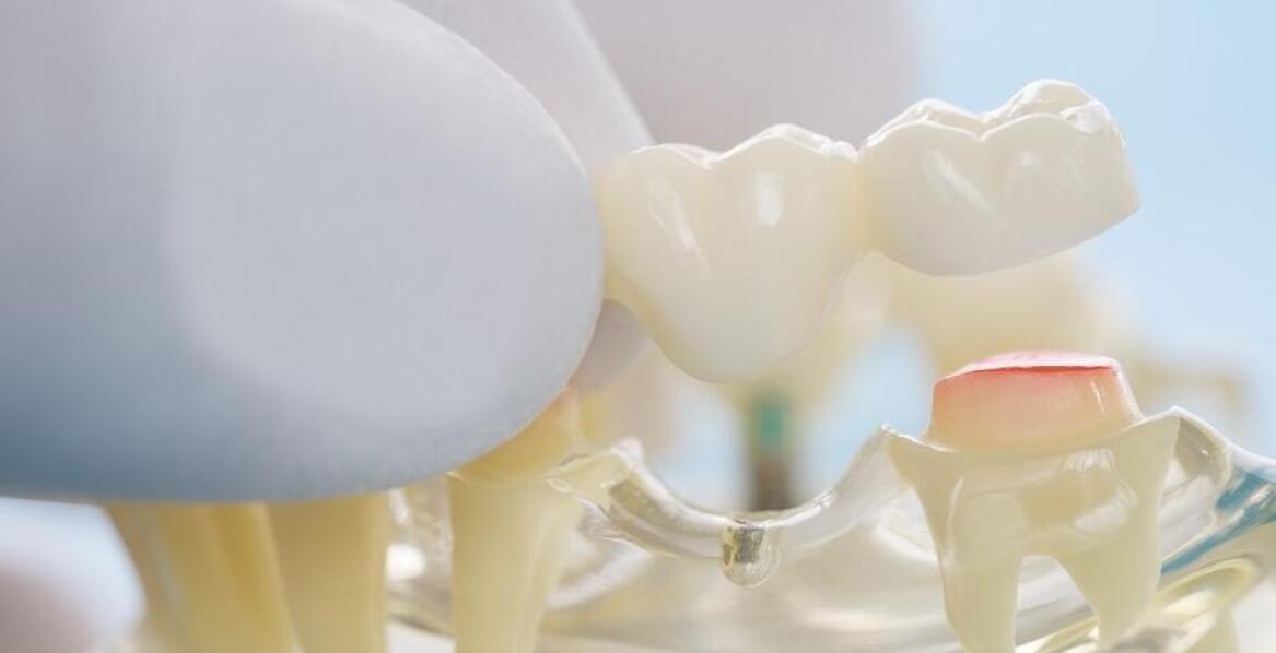 Protetyka stomatologiczna – jakie możliwości oferuje współczesna stomatologia?