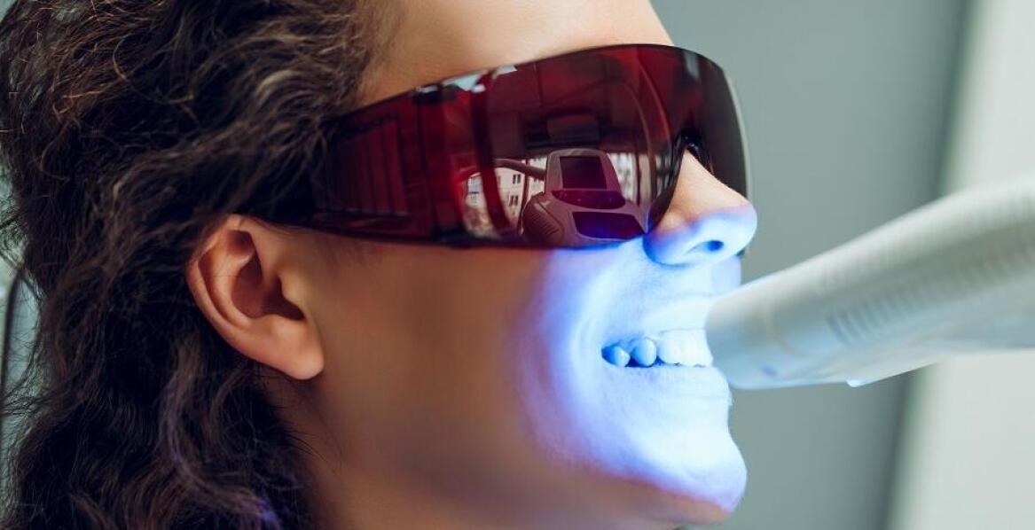 Jakie są zalety stosowania nowoczesnych lamp LED w wybielaniu zębów?