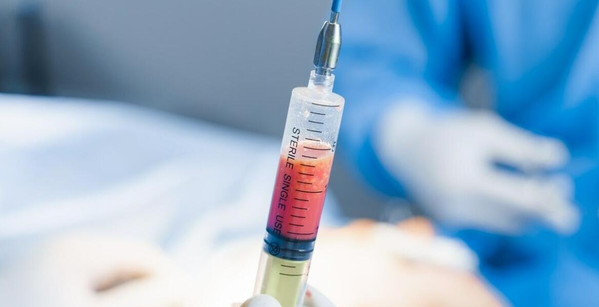 Korzyści z zastosowania terapii PRP w regeneracji tkanek