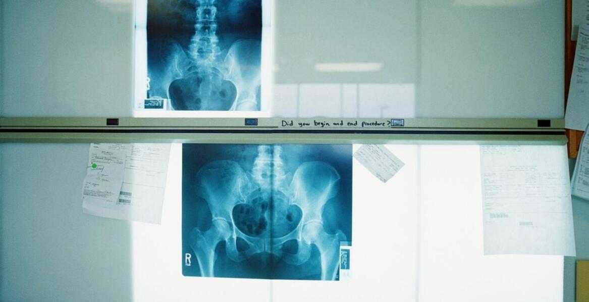 Wpływ zaawansowanych funkcji programów do zdjęć RTG na precyzję diagnostyki