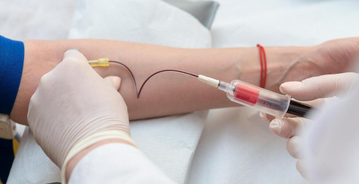 Efekty zabiegów z osoczem bogatopłytkowym – co warto wiedzieć?