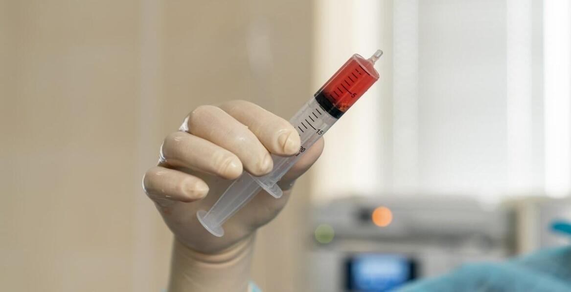 Kiedy warto rozważyć zabieg z osoczem bogatopłytkowym na trądzik?