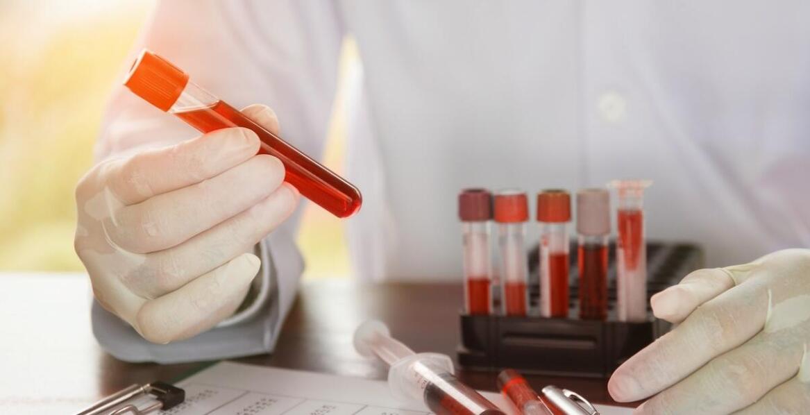 Czy można pić alkohol przed badaniami profilaktycznymi krwi?