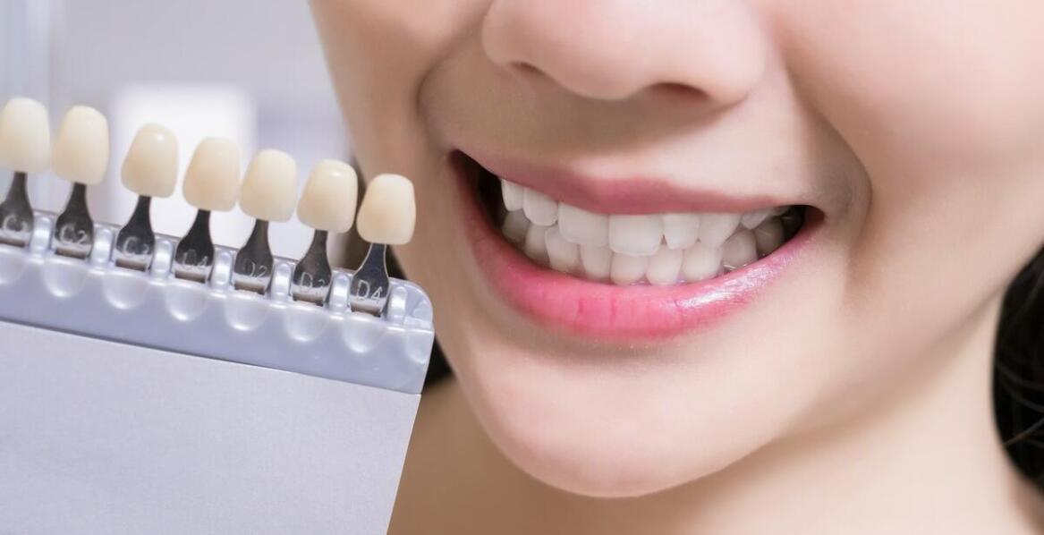 Wpływ estetycznej stomatologii na jakość życia pacjentów