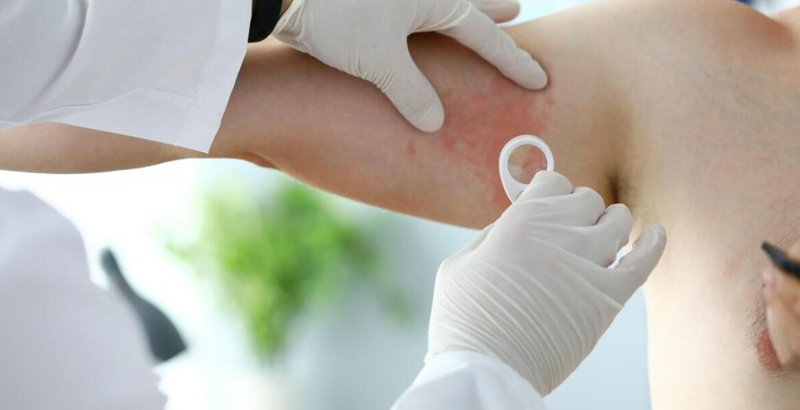 Świerzb a inne pasożytnicze choroby - co warto wiedzieć?