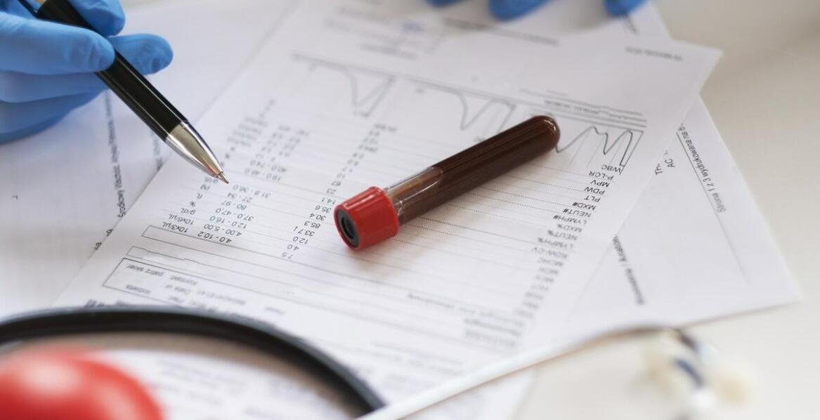 Jakie hematologiczne badania są kluczowe w diagnostyce interny?