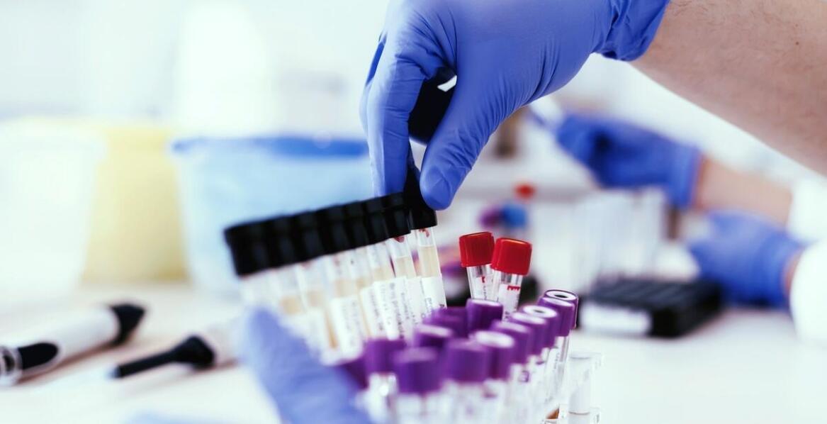 Znaczenie laboratoryjnej diagnostyki w monitorowaniu alergii