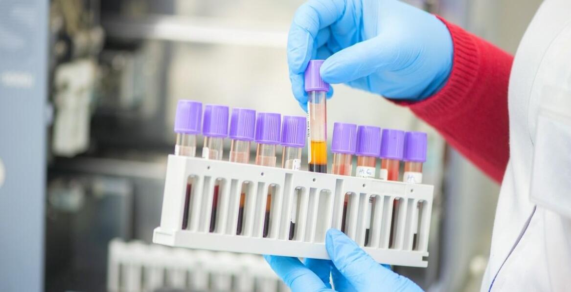 Jak diagnostyczne testy przyczyniają się do szybkiego wykrywania zakażeń CMV?