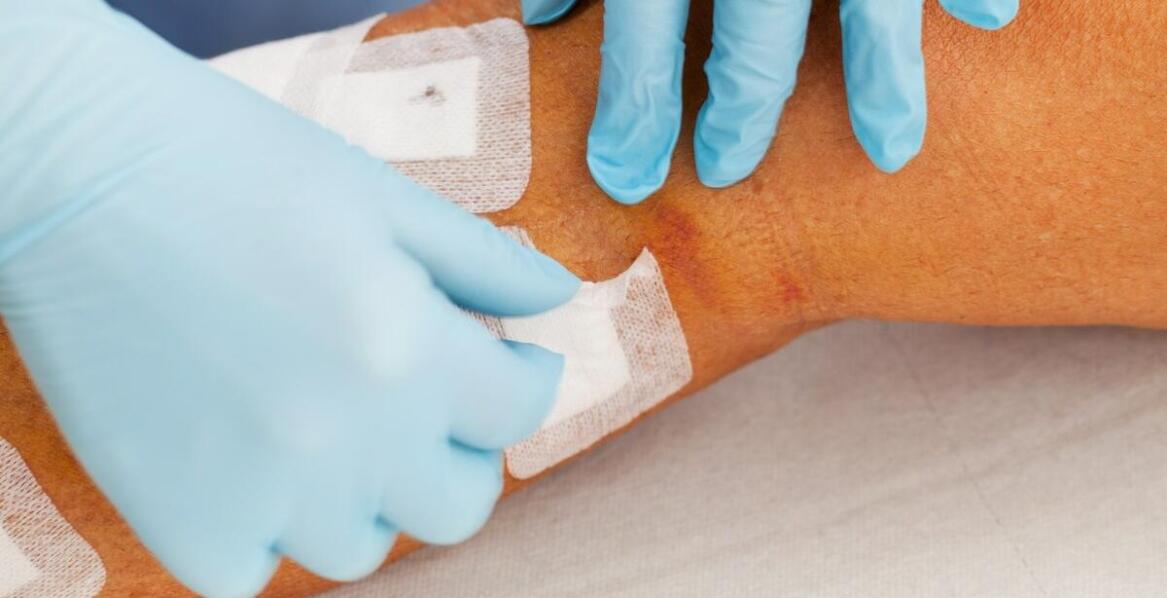 Znaczenie alergicznych testów w kontekście psychicznego zdrowia