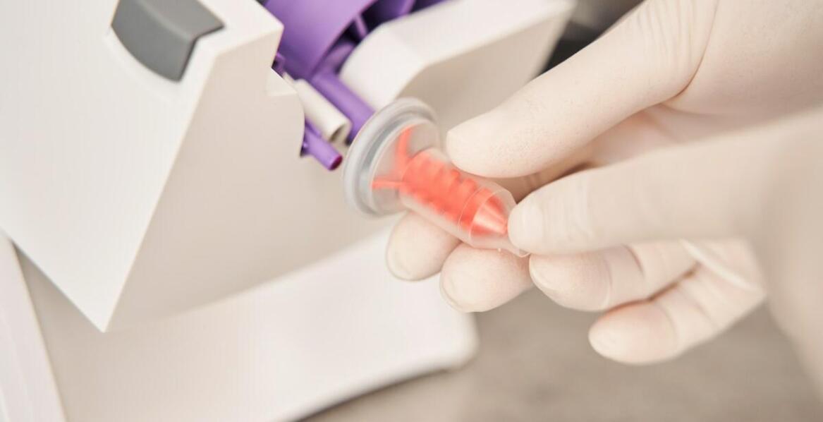 Wirówka do A-PRF w praktyce – najważniejsze aspekty użytkowania