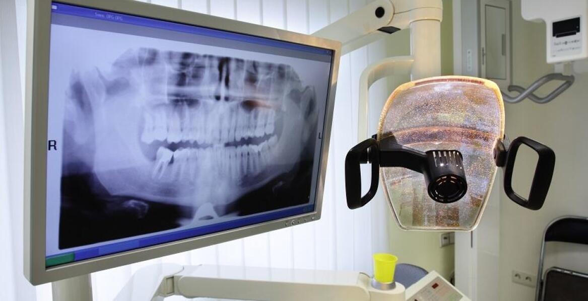 USG w stomatologii. Znaczenie i wskazania do badania