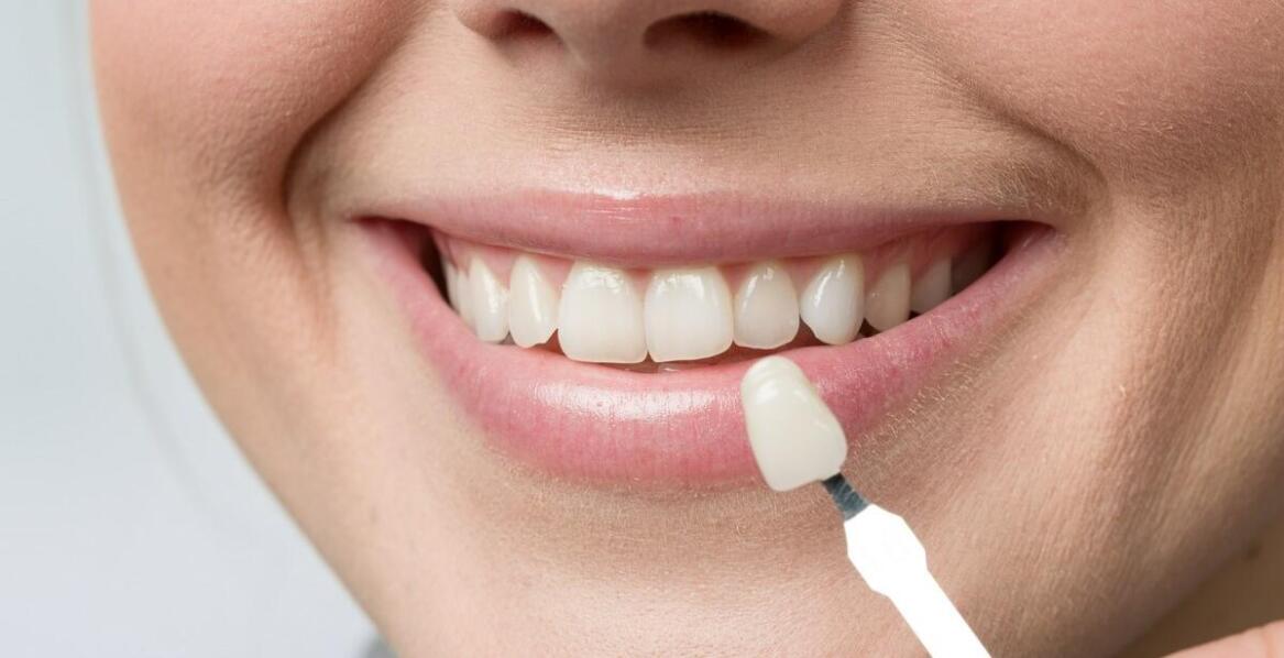 Korekta kształtu zębów przy użyciu porcelanowych licówek – co oferuje stomatolog?