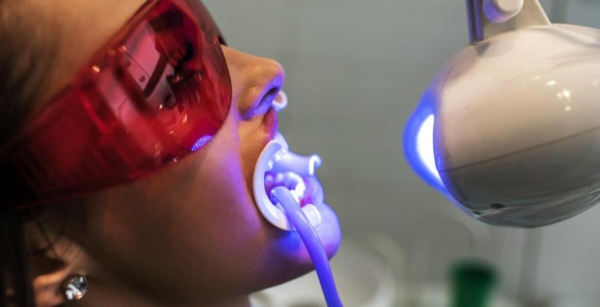 Czy czas trwania szynowania zębów wpływa na skuteczność tego zabiegu?