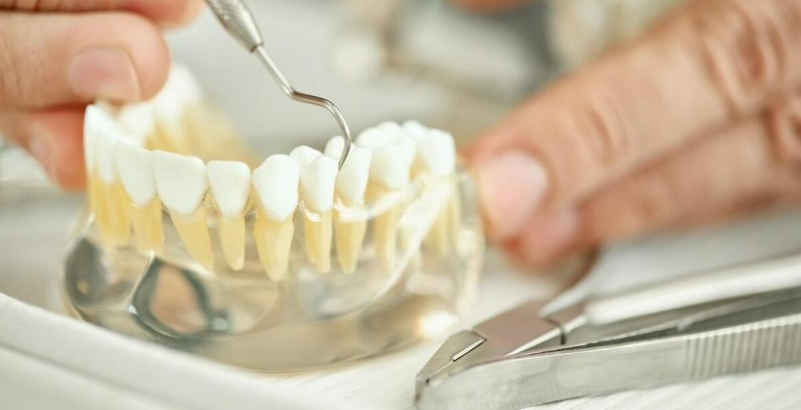 Skuteczność zębowych implantów w porównaniu do tradycyjnych protez