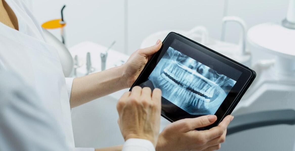 Jak cyfrowa radiowizjografia wspiera zachowawcze leczenie?