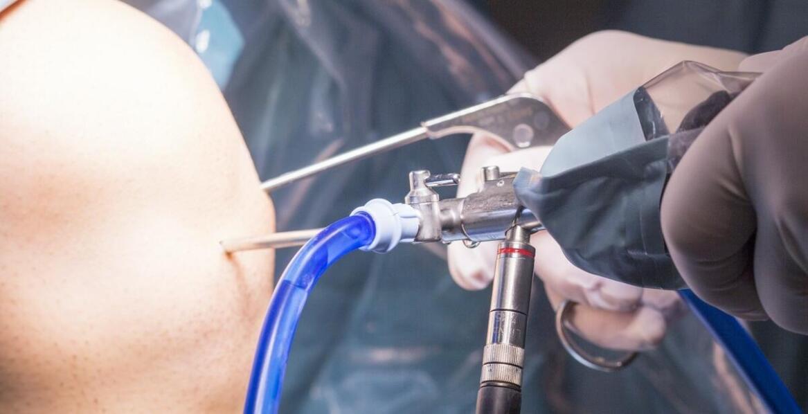 Jakie są możliwości leczenia barku z użyciem artroskopii?