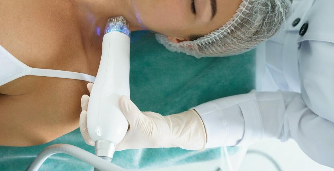 Laserowe usuwanie skórnych zmian – jakie korzyści oferuje nowoczesna dermatologia?