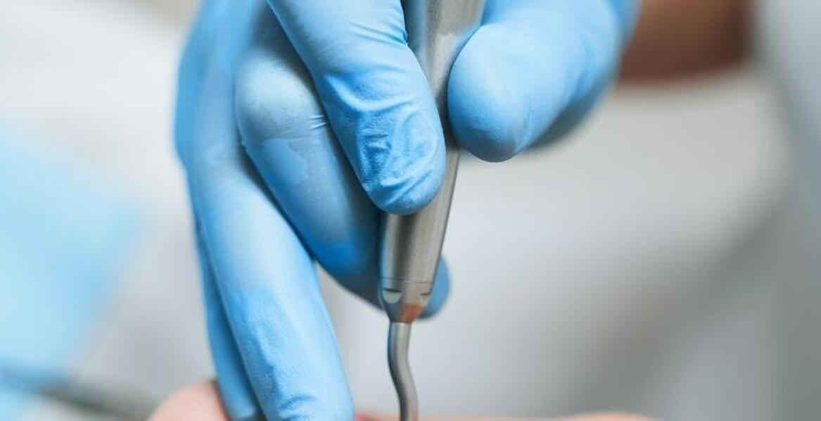 Jak skaling i piaskowanie wspierają walkę z nazębnym kamieniem?