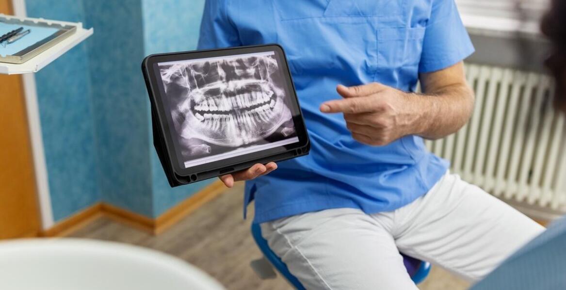 Leczenie zębów a nowoczesna diagnostyka: znaczenie 3D tomografii w planowaniu terapii